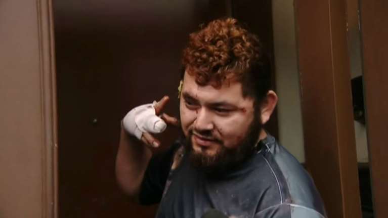 ΗΠΑ: Τσακώθηκαν για τον Τραμπ και του έκοψε το αυτί