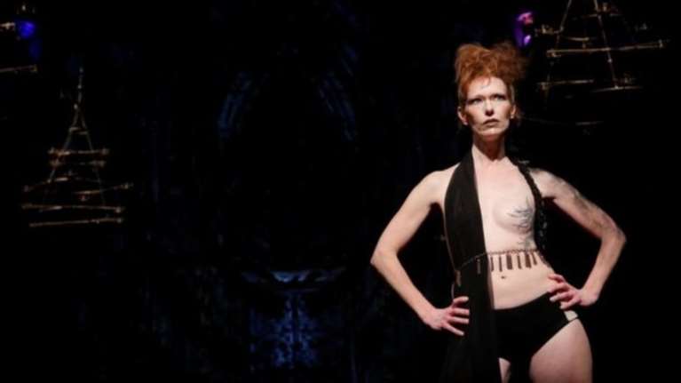 Ατρόμητες γυναίκες που νίκησαν τον καρκίνο του μαστού στη NYFW