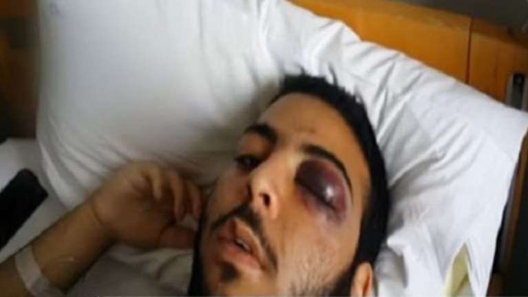 Άγριος ξυλοδαρμός 17χρονου στο Γκάζι από πορτιέρηδες σε μπαρ