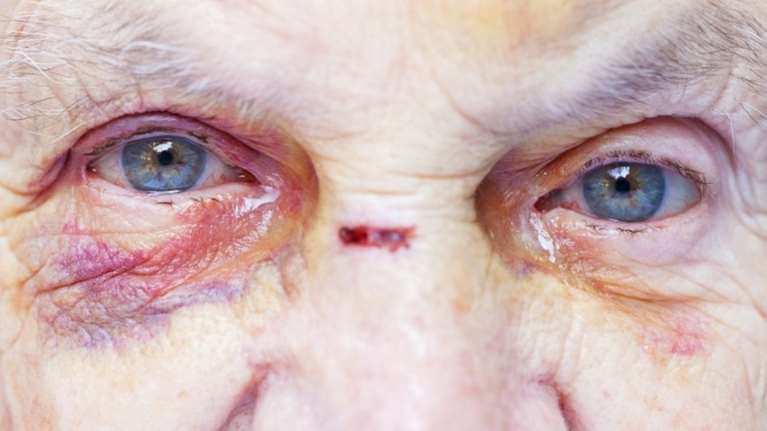 Κρήτη: Έβαλε κάμερες και είδε την κακοποίηση της 79χρονης μητέρας της