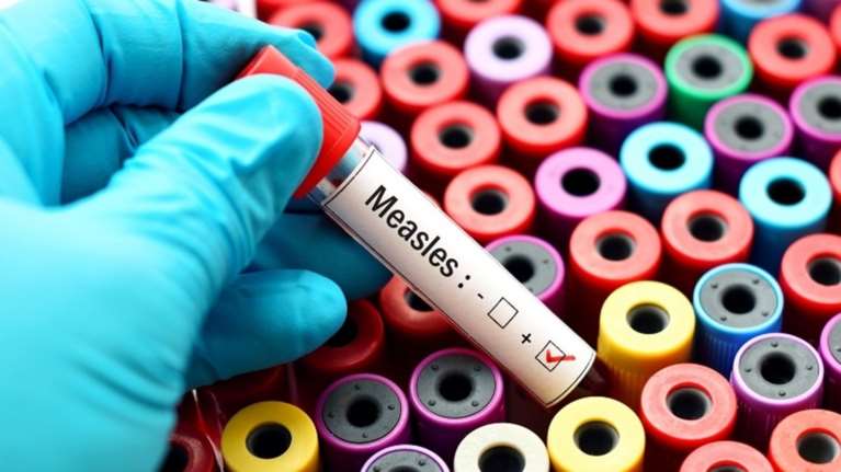 ΚΕΕΛΠΝΟ: Είμαστε σε φάση επιδημικής έξαρσης της ιλαράς