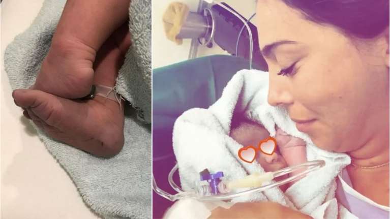 Η Χοψονίδου αγκαλιά με το νεογέννητο μωρό της αμέσως μετά τη γέννα [Βίντεο]