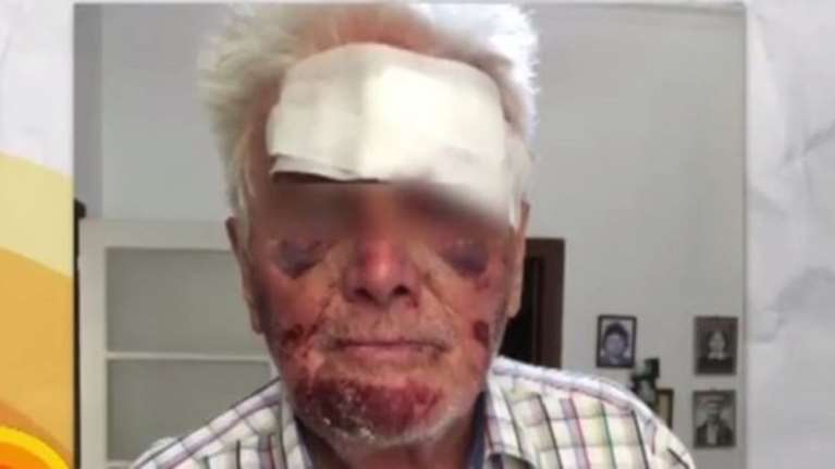 Ληστές βασάνισαν άγρια 90χρονο στο Γαλάτσι για 5 ευρώ