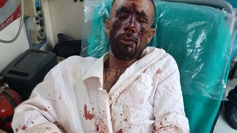 Ψάχνουν 17χρονο και άλλους 4  για τη ρατσιστική επίθεση στον Ασπρόπυργο