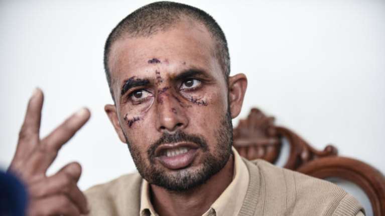 Τρεις συλλήψεις για τη δολοφονική επίθεση στον Ασπρόπυργο