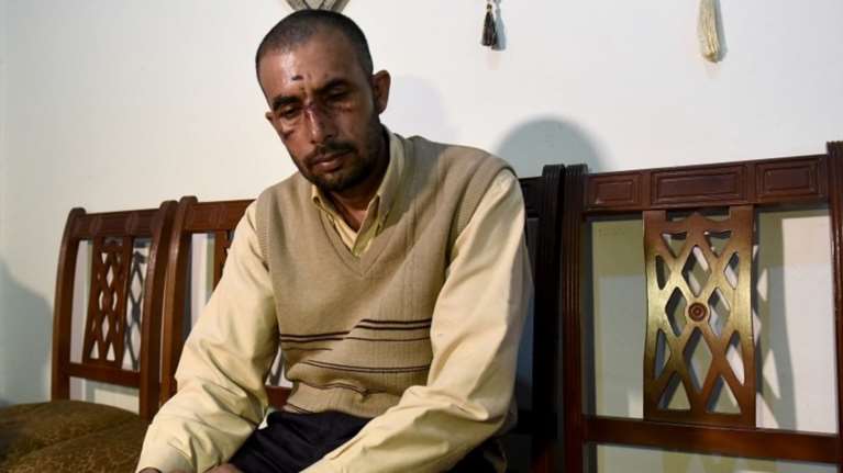 Εφηβικό ακροδεξιό &quot;τάγμα εφόδου&quot; στον Ασπρόπυργο