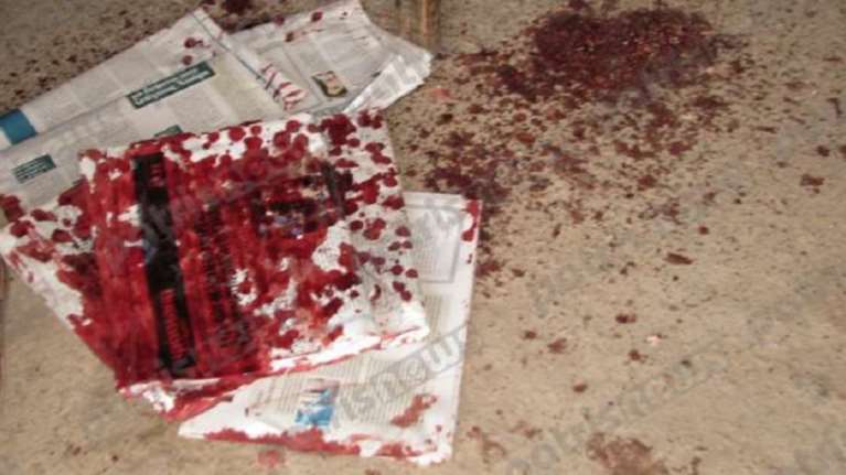 Σε κρίσιμη κατάσταση 73χρονος που αυτοπυροβολήθηκε στο πρόσωπο (ΦΩΤΟ)