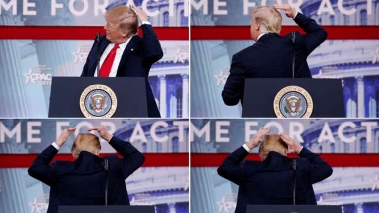 Ομολογία Τραμπ: Προσπαθώ πολύ να καλύψω τη φαλάκρα μου