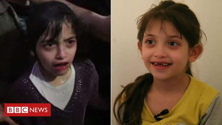 Η μικρή Μάσα για την επίθεση με χημικά: «Αναπνέαμε την οσμή του αίματος»