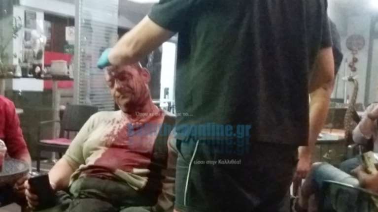 Επίθεση σε φύλακα πάρκου στην Καλλιθέα - τραυματίστηκε σοβαρά