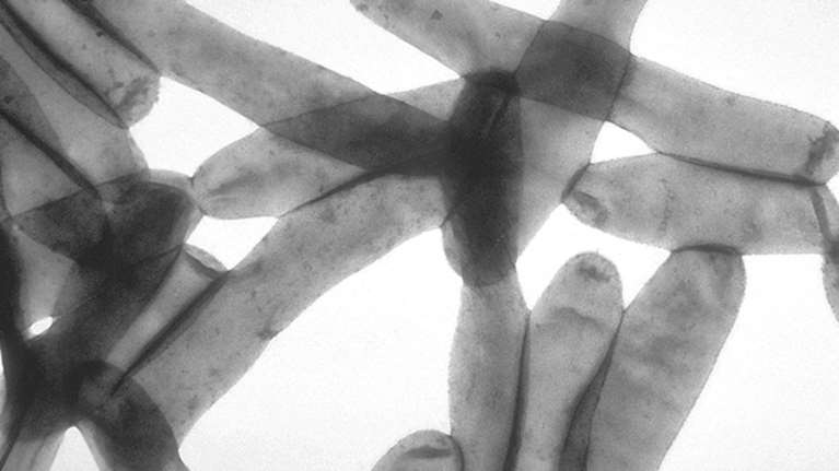 Νόσος των Λεγεωνάριων: Δέκα ερωτήσεις και δέκα απαντήσεις