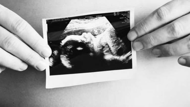 Δίκη στην Κω για άμβλωση σε 13χρονη - Στο εδώλιο δύο άνδρες