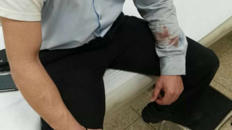 Τραυματίστηκαν αστυνομικοί μετά από επίθεση με μάρμαρα [εικόνες]