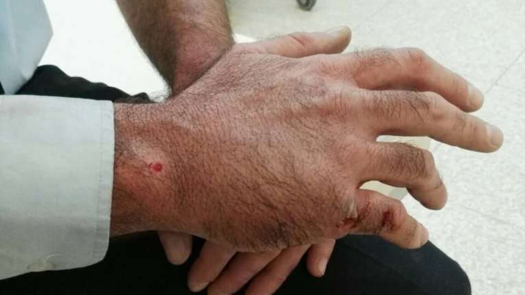 Έξι συλλήψεις για την επίθεση στους αστυνομικούς στην Πειραιώς