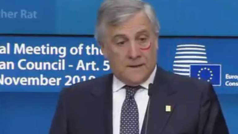 Με κραγιόν κάτω από το μάτι ο Ταγιάνι για την υποστήριξη των γυναικών