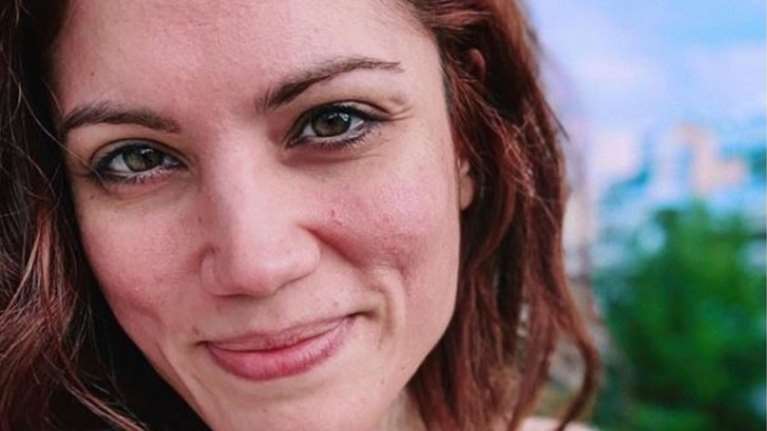 Μαίρη Συνατσάκη: Η πάθηση στο δέρμα της και η απάντηση στα άσχημα σχόλια