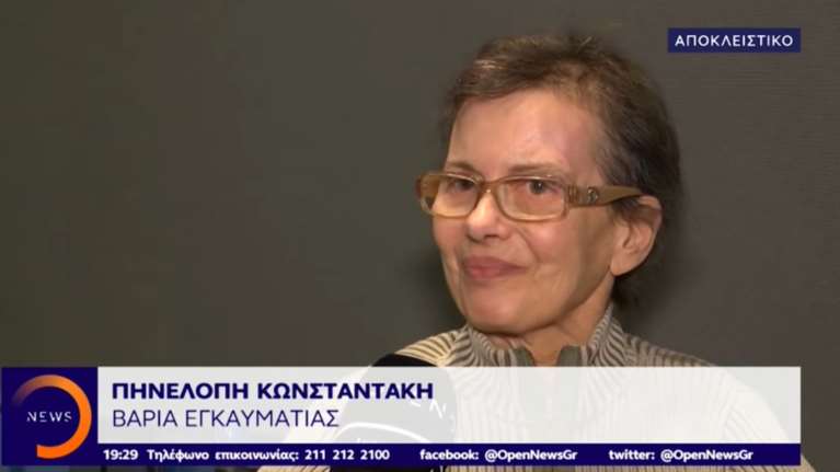 Πήρε εξιτήριο και η τελευταία εγκαυματίας από το Μάτι