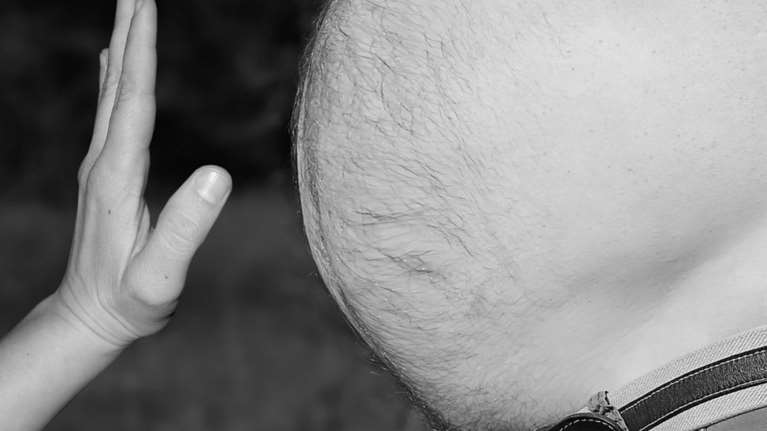 Η παχυσαρκία &quot;κυριαρχεί&quot; κυρίως στην ύπαιθρό και όχι στην πόλη