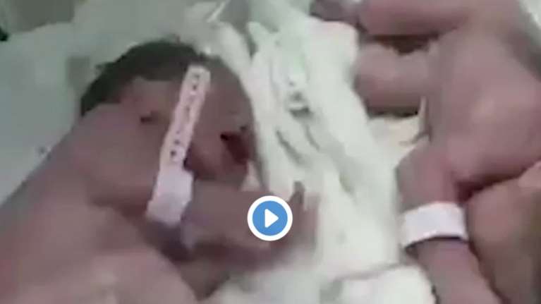 Συγκίνηση: Δίδυμα γεννήθηκαν 20&#39; μετά τον σεισμό στην Αλβανία