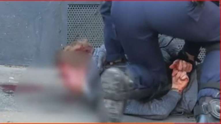 Οργή στη Γαλλία για τον ξυλοδαρμό διαδηλωτή- Ηταν πεσμένος και αιμόφυρτος