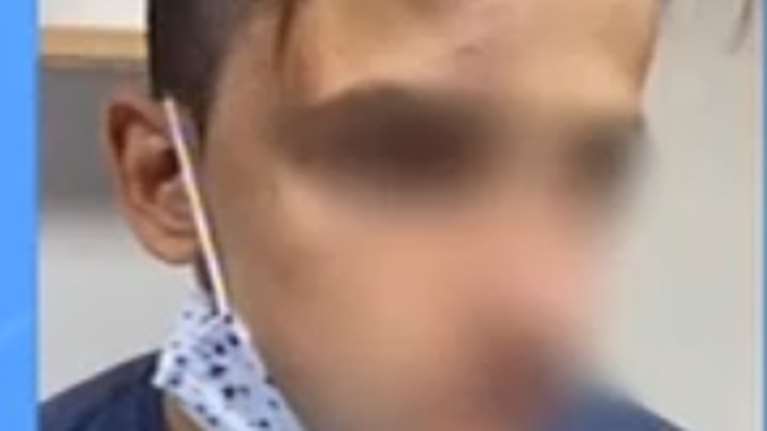 Γαλάτσι: Σοκάρει νέα υπόθεση ξυλοδαρμού ανηλίκου - 20 άτομα χτυπούσαν έναν 17χρονο