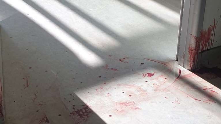 Εικόνες σοκ από το Αττικό νοσοκομείο: Εστησε ενέδρα, μαχαίρωσε νοσηλεύτρια και αυτοκτόνησε πηδώντας από τον 5ο όροφο