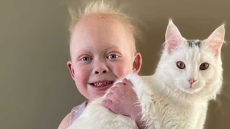 Bella the Brave: Η 8χρονη με γενετική ανωμαλία μοιάζει με βρέφος και σαρώνει στο Tik Tok