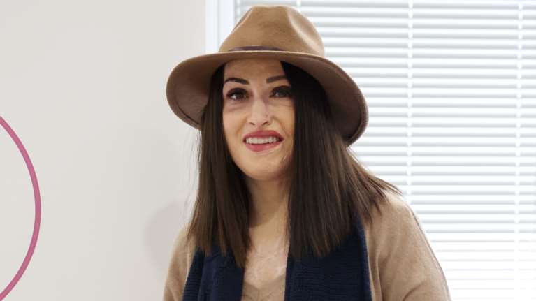 Παλιοσπύρου: Δεν νιώθω θυμό για τη γυναίκα που μου επιτέθηκε - Δυσκολεύτηκα  να βρω το θάρρος να με κοιτάξω στον καθρέφτη