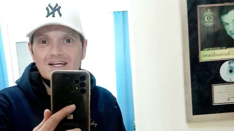 Γιώργος Δασκαλάκης: Συγκλονιστική φωτό - Πώς είναι το σώμα του μετά τις δεκάδες εγχειρήσεις