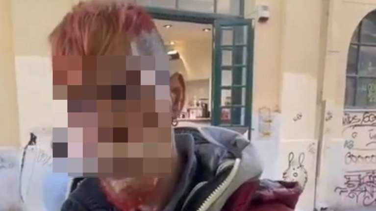 Αθήνα: Αυτός είναι ο 57χρονος που παρενόχλησε σεξουαλικά τα δύο ανήλικα κορίτσια - Τα θώπευσε και τα φίλησε