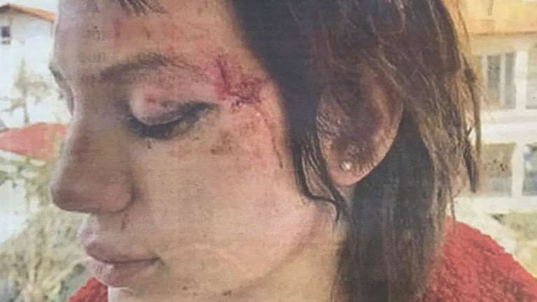 Μαρία Αλεξάνδρου: Μιλά για τον αδιανόητο εφιάλτη - Πώς την άρπαξαν και την έσπασαν στο ξύλο [βίντεο]