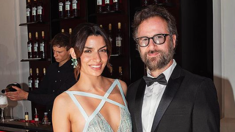 Ο Κωστής Μαραβέγιας δείχνει τα σημάδια της λεύκης στο σώμα του: &quot;Αγαπώ τη λεύκη&quot;