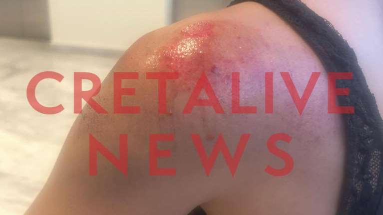 Ασύλληπτες σκηνές στην Κρήτη: Φωτογράφισε κρυφά τα οπίσθιά της, τη χτύπησε με μηχανάκι και την έσυρε στο οδόστρωμα