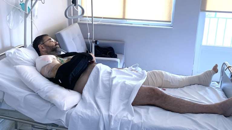 Σοβαρό τροχαίο για τον Σταύρο Μπαλάσκα που οδηγούσε τη μηχανή του: Ξαφνικά έπαψα να έχω δεξί χέρι, δεν κινούνταν [Εικόνα]