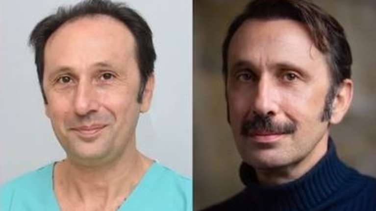 Μεταμόσχευση μαλλιών: Διάσημοι Έλληνες που παραδέχθηκαν δημοσίως πως έκαναν εμφύτευση - Πόσο κοστίζει