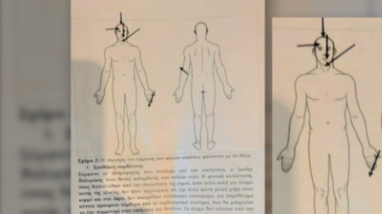 Υπόθεση Βαλυράκη: Το σκίτσο που ρίχνει φως στα αίτια θανάτου - Το πόρισμα και τα τραύματα στο πρόσωπο [βίντεο]