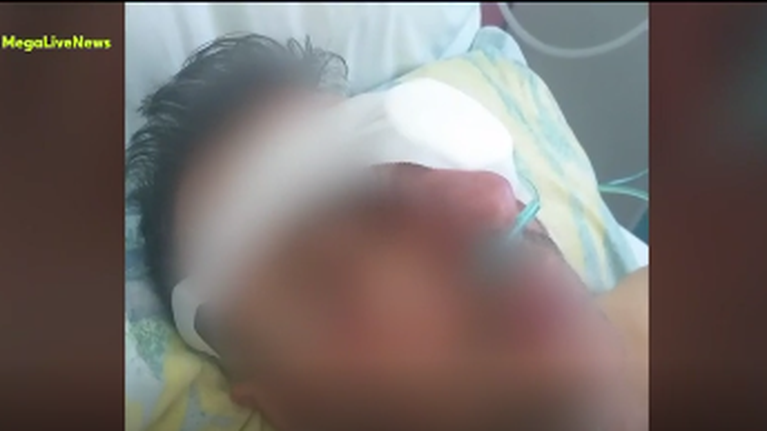 Χανιά: &quot;Μου έβγαλε το μάτι με το δάχτυλό του&quot; - Έχασε οριστικά τη μισή όρασή του ο 47χρονος για ένα... κέρασμα