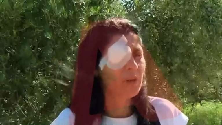 Επίθεση με οξύ στη Μεσσήνη: &quot;Ούρλιαζα από τους πόνους&quot; - Πώς υποψιάστηκε η 49χρονη τον πρώην σύζυγό της