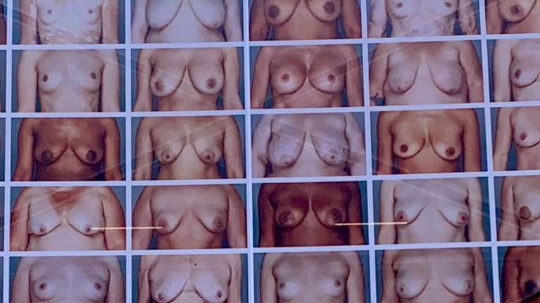 Διαφήμιση - παρέμβαση της Adidas με 25 διαφορετικά γυμνά γυναικεία στήθη