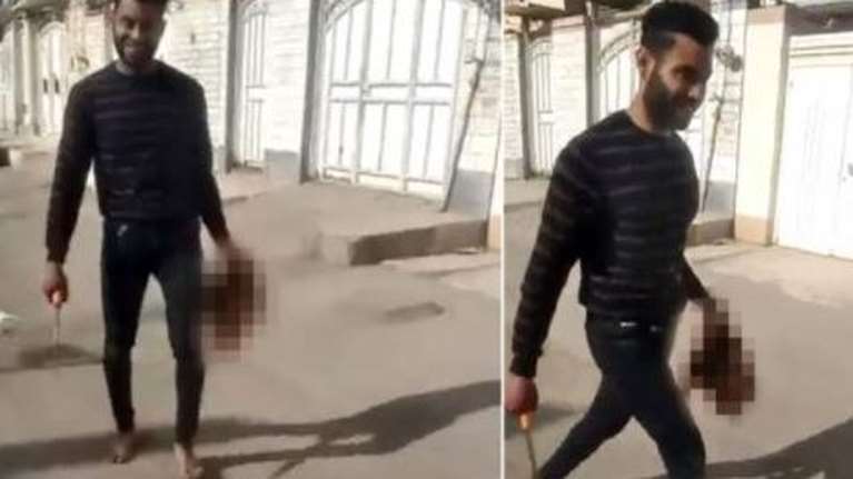 Άγρια γυναικοκτονία στο Ιράν: Άνδρας αποκεφάλισε την 17χρονη σύζυγό του και έκανε βόλτες με το κομμένο κεφάλι της