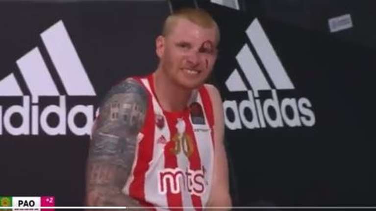 Μπάσκετ: Σοκαριστικός τραυματισμός για πρώην παίκτη του Παναθηναϊκού - Σκληρές εικόνες