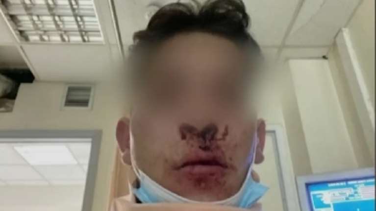 Θεσσαλονίκη: Βίντεο ντοκουμέντο με τον άγριο ξυλοδαρμό 22χρονου από ομάδα τραμπούκων στη μέση του δρόμου