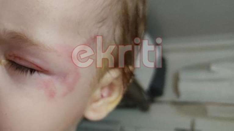 Κρήτη: Τι απαντά η ιδιοκτήτρια του σκύλου που δάγκωσε το βρέφος στην Αμμουδάρα