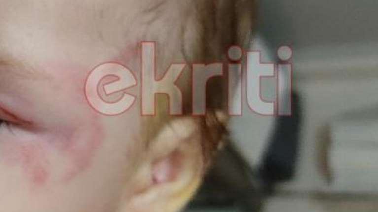 Κρήτη: Περιγραφή σοκ του πατέρα του βρέφους για την επίθεση από λυκόσκυλο - &quot;Χύμηξε πάνω στο παιδί να του βγάλει τα μάτια&quot;