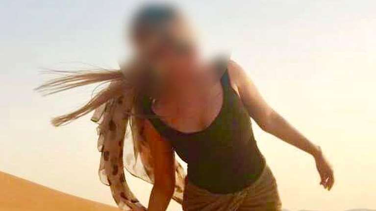 Επίθεση με βιτριόλι: Εγκαύματα στο 93% του προσώπου της έχει η 34χρονη - Τι λένε οι γιατροί [βίντεο]