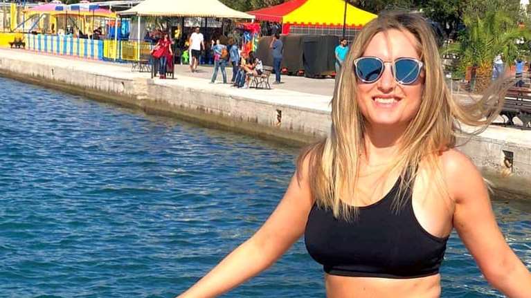 Επίθεση με βιτριόλι: Σοκαριστικές εικόνες - Έτσι ήταν το πρόσωπο και το χέρι της Ιωάννας μετά το πρώτο χειρουργείο