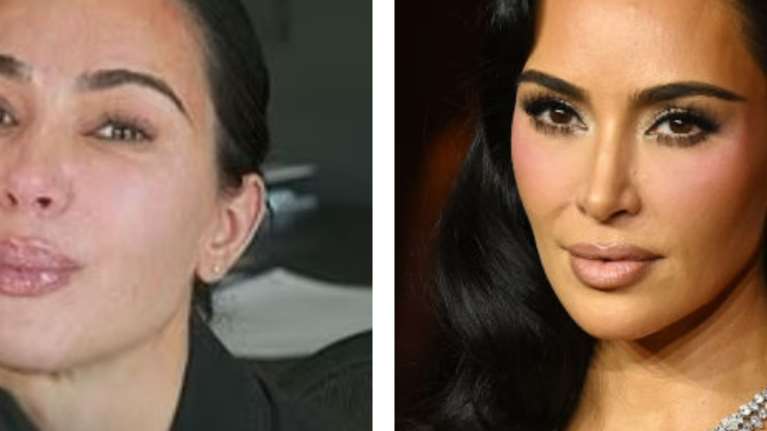 Η Κιμ Καρντάσιαν διαγνώστηκε με ανεύρυσμα στον εγκέφαλο - Το αποκάλυψε με δάκρυα στα μάτια