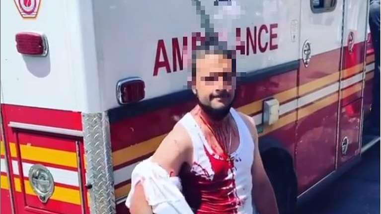 Απίστευτες εικόνες στο Χάρλεμ: Αιμόφυρτος άνδρας περπατά με ένα μαχαίρι καρφωμένο στο κεφάλι του