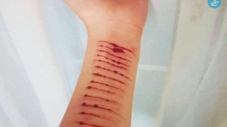 Σοκ στην Ρόδο: Αποπλάνησε 12χρονη μέσω του ίντερνετ για να του στείλει γυμνές φωτογραφίες και να αυτοτραυματιστεί