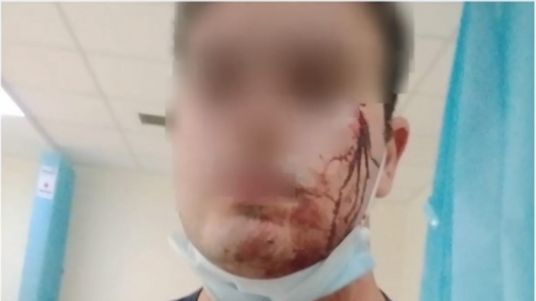 Κορονοϊός - Μενίδι: Επιτέθηκαν σε αστυνομικούς που πήγαν να σταματήσουν γλέντι – Δύο τραυματίες [βίντεο]